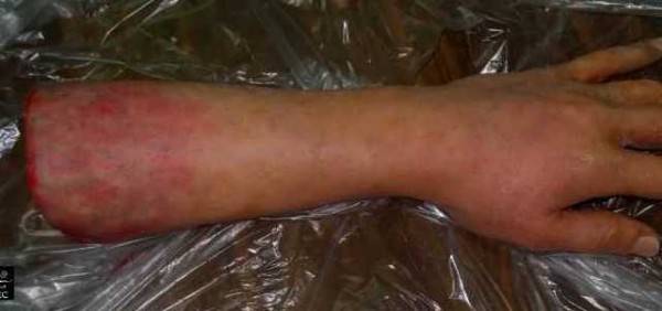 braccio_amputato_2.jpg (800×313)