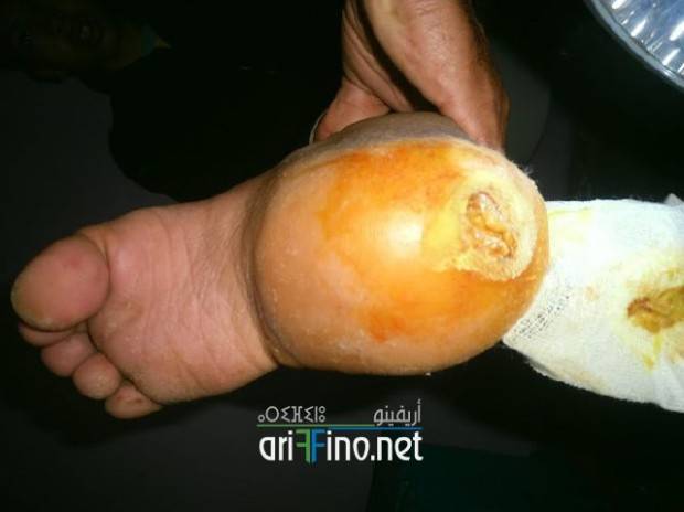 nador0684